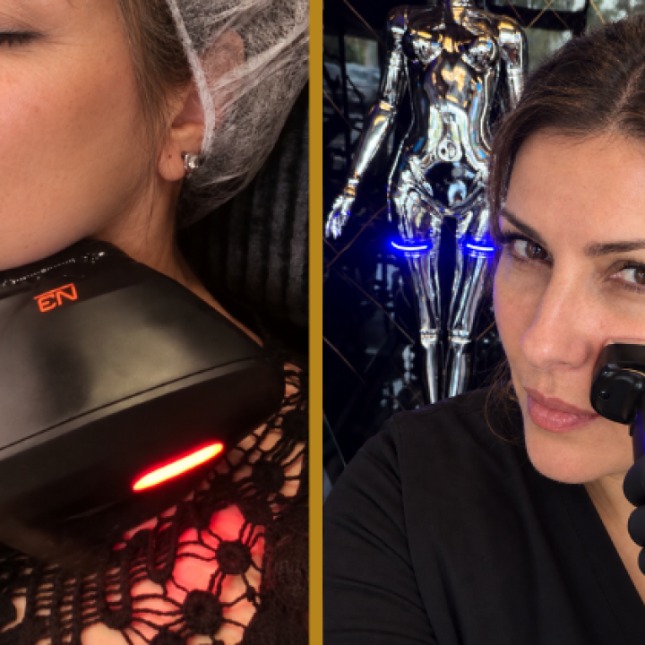 2-in-1 Face Lift at ELURENA: 10D HIFU + Bipolar RF Skin Tightening