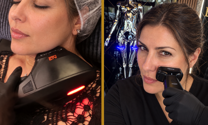 2-in-1 Face Lift at ELURENA: 10D HIFU + Bipolar RF Skin Tightening