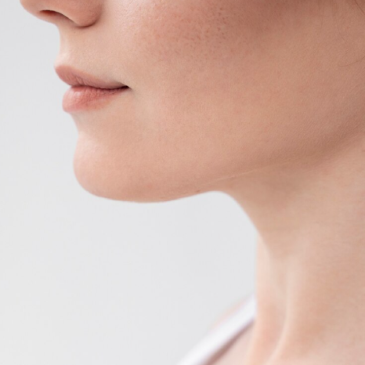Double Chin - Fat Freezing / CryoSlim 360°